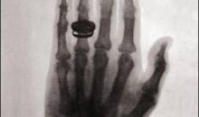 1896 - La primera foto de rayos x en un humano