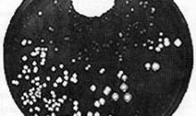1928 – Fotos que cambiaron el mundo científico: Penicillium notatum